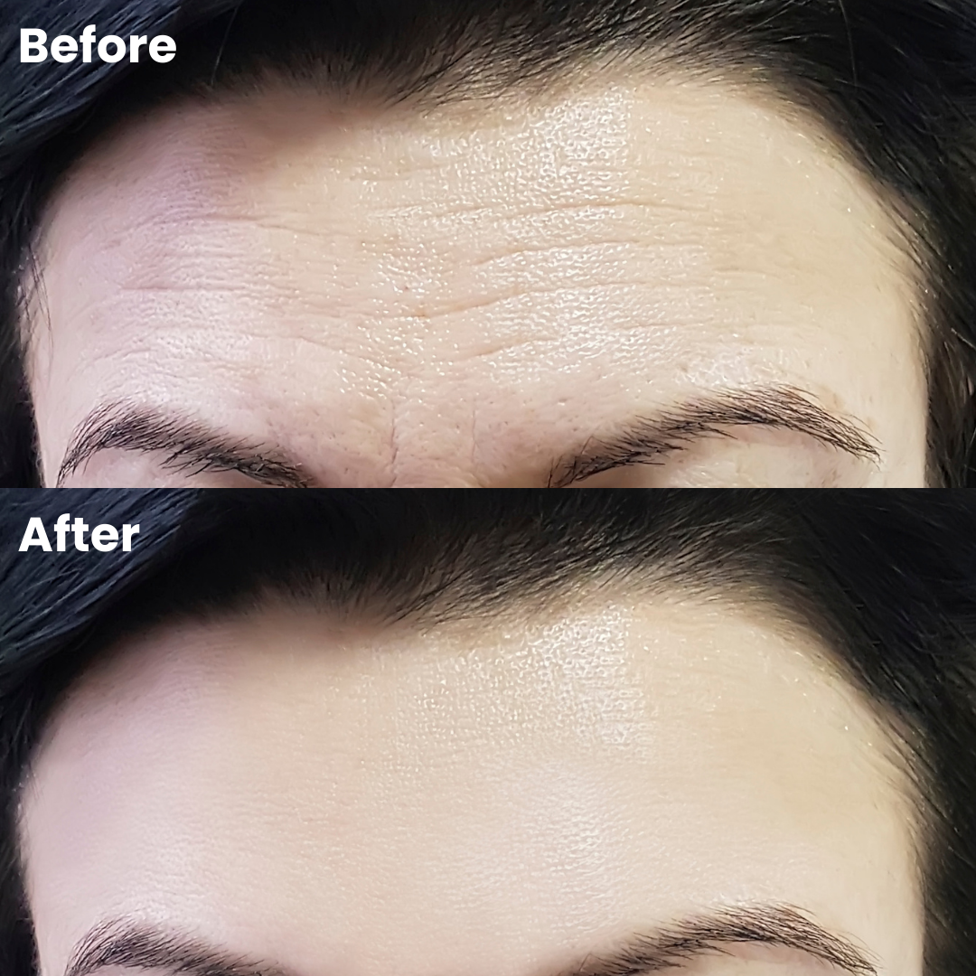 BELLUSI Wrinkle Smoothing Patches